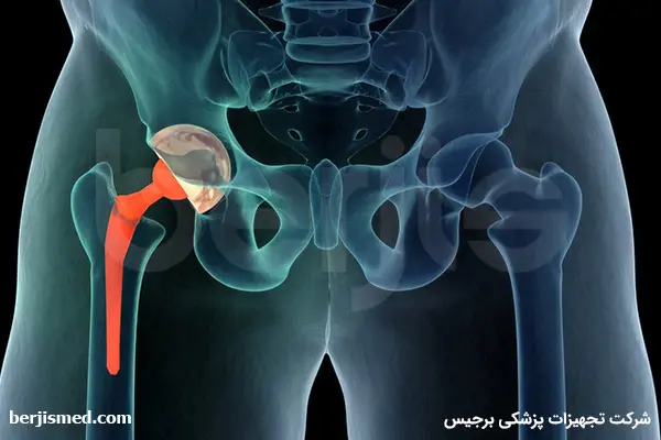 قیمت دستگاه فیزیوتراپی