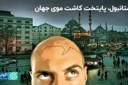 استانبول به پایتخت کاشت موی جهان تبدیل شد