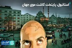 استانبول به پایتخت کاشت موی جهان تبدیل شد