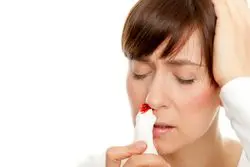 آیا برای خون دماغ زیاد باید به متخصص خون مراجعه کرد؟