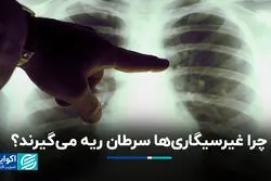 چرا غیرسیگاری‌ها سرطان ریه می‌گیرند؟