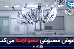 هوش مصنوعی عضو اهدا می‌کند
