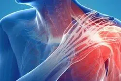 برای درد کتف به چه دکتری مراجعه کنیم