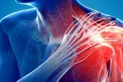 برای درد کتف به چه دکتری مراجعه کنیم
