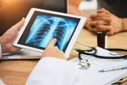 امکان تشخیص مرگبارترین سرطان جهان به کمک هوش مصنوعی 