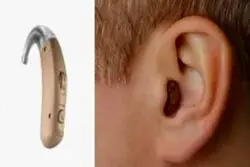 قرار گرفتن ایران در جمع ۱۰ کشور دارنده فناوری سمعک دیجیتال