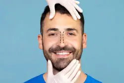 هزینه جراحی بینی در ایران؛ بررسی عوامل موثر و قیمت‌ها