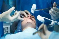 بینی‌های سیاه و صورت‌های ورم‌کرده؛ آیا پکن، ترمز صنعت زیبایی را می‌کشد؟ 