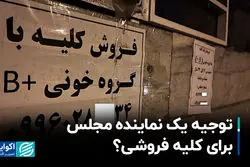 توجیه یک نماینده مجلس برای کلیه فروشی؟