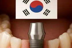 بهترین برند ایمپلنت کره ای کدام است ؟