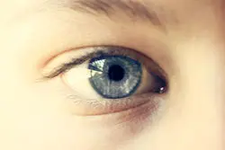 تشخیص اوتیسم با هوش مصنوعی