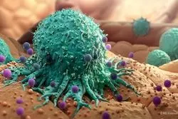 امکان درمان سرطان بدون عوارض جانبی فراهم شد