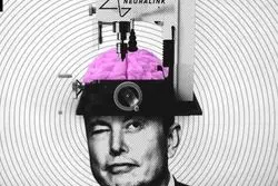 صدور مجوز برای آزمایشات انسانیِ تراشه‌های مغزی ایلان ماسک