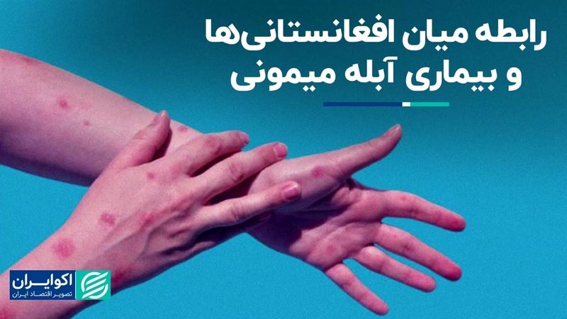 آیا آبله میمونی ربطی به افغانستانی‌ها دارد؟ 