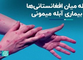 آیا آبله میمونی ربطی به افغانستانی‌ها دارد؟ 