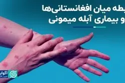 آیا آبله میمونی ربطی به افغانستانی‌ها دارد؟ 
