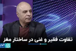 اثر فقر بر مغز؛ تفاوت غنی و‌ فقیر در ساختار مغز