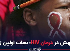 جهش در درمان HIV؛ نجات اولین زن