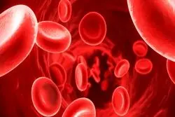 تشخیص علائم اختلالات خونی مزمن در مردان و زنان