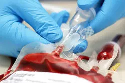 خواب صنعت پلاسما در دولت پزشکیان / تکرار  سیاست غلط دولت روحانی 