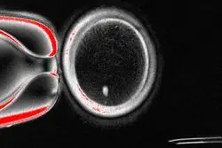 این فناوری ناباروری را ریشه‌کن می‌کند