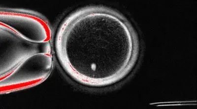 این فناوری ناباروری را ریشه‌کن می‌کند