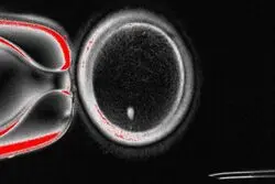 این فناوری ناباروری را ریشه‌کن می‌کند
