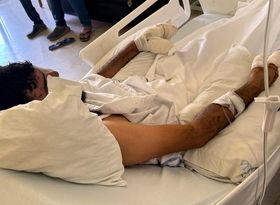 انجام هزاران عمل جراحی برای مجروحان پیجرهای لبنانی