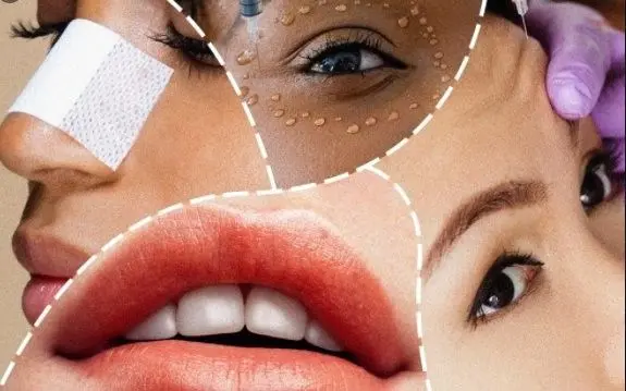 مقایسه گردش مالی بازار عمل های زیبایی در دنیا و ایران