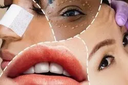 مقایسه گردش مالی بازار عمل های زیبایی در دنیا و ایران