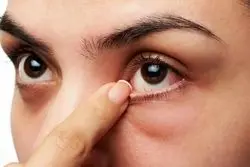 چه افرادی در معرض ابتلا به خشکی چشم هستند؟