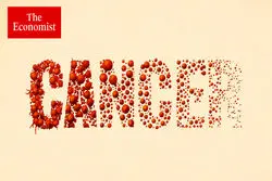 اکونومیست: جهان در حال پیروزی بر سرطان است