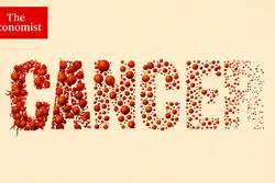 اکونومیست: جهان در حال پیروزی بر سرطان است