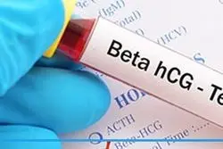 تشخیص مشکلات جنین با آزمایش BHCG