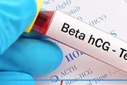 تشخیص مشکلات جنین با آزمایش BHCG