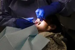 غربالگری سلامت دهان از امسال در مدارس