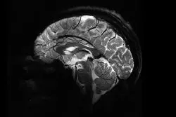 تصاویر فوق‌العاده دقیق قدرتمندترین دستگاه اِم‌آرآی جهان از مغز انسان