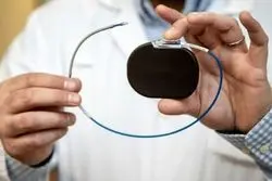 پایان دردسرهای جراحی: شارژ سریع ایمپلنت‌ها با فناوری فراصوت