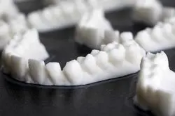 بازار ایمپلنت دندان تا 2030 مرز 6 میلیارد دلار را رد می‌کند.