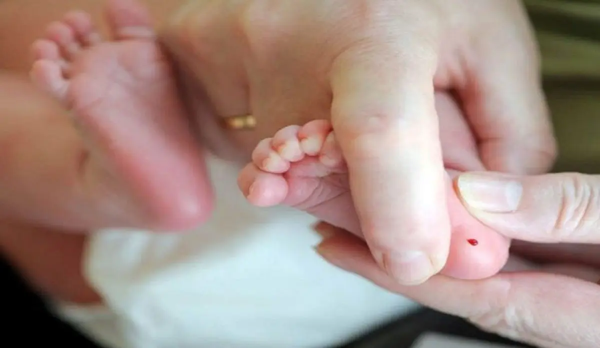 غربالگری مادران باردار حذف شد؟ 